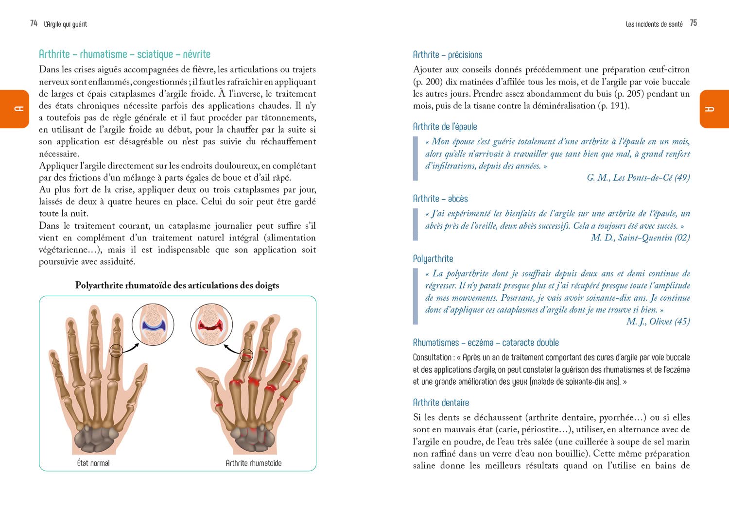 L'ARGILE QUI GUERIT – Image 2